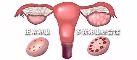 卵巢照片,揭秘女性生殖健康奥秘  第3张