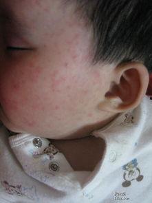 婴儿急诊图片,紧急关头的温馨守护