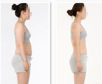 明星 抽脂,揭秘抽脂术的神奇效果  第3张